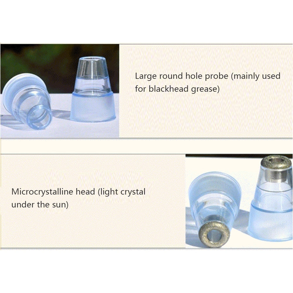 All in One Microdermabrasion, Pore Vacuum & Blackhead Remover